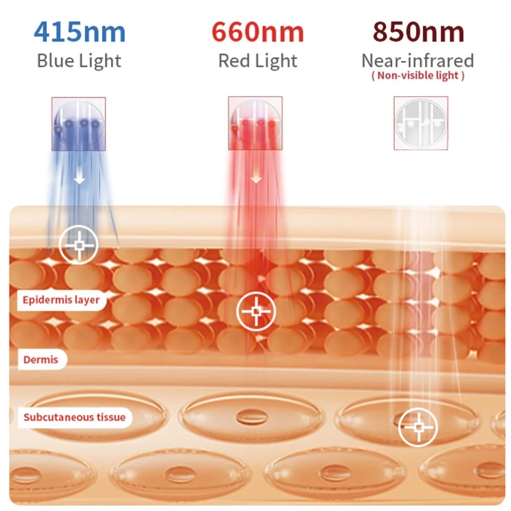LumaDerm™ Roodlichttherapie gezichtspuls